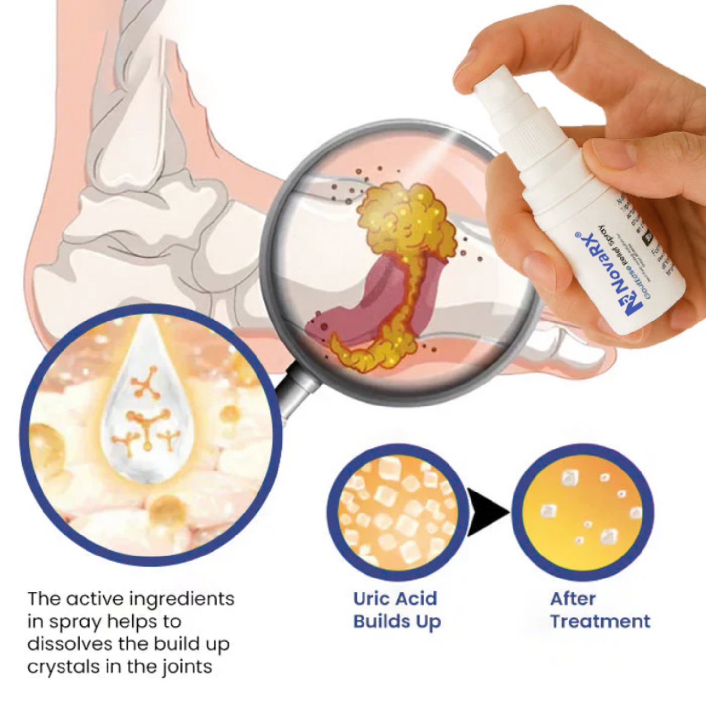 NoveRX GoutEase Relief Spray