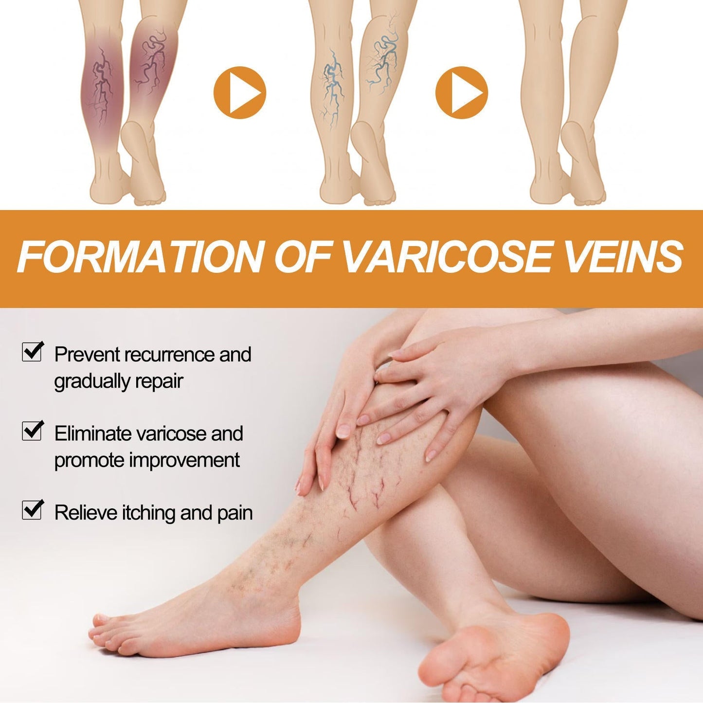 Butikindia - Buy 1 Get 2 Doctor Recommended Turmeric Varicose Vein Relief Spray 🔥 🎁 + 5-Page Exercise & Usage Guide PDF Absolutely FREE FREE