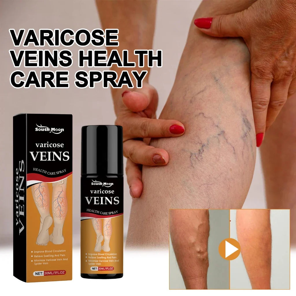 Butikindia - Buy 1 Get 2 Doctor Recommended Turmeric Varicose Vein Relief Spray 🔥 🎁 + 5-Page Exercise & Usage Guide PDF Absolutely FREE FREE